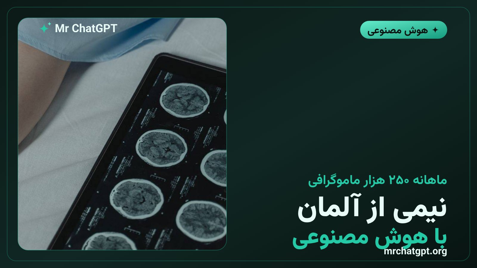 استقرار هوش مصنوعی Vara در بیش از نیمی از برنامهٔ غربالگری سرطان پستان آلمان